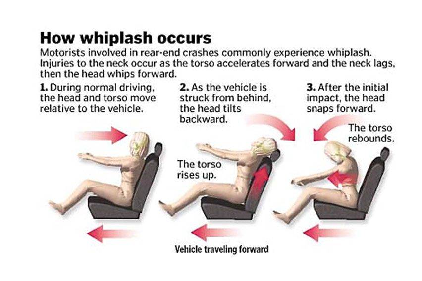 Whiplash